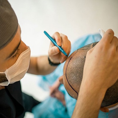 One Dirham Hair Transplant: Is It Too Good to Be True?